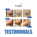 Argasol Wound & Sanitisation Spray (118ml)